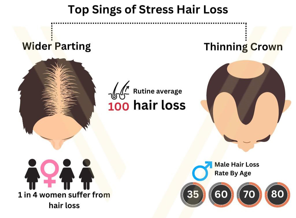 figure 2 stress
